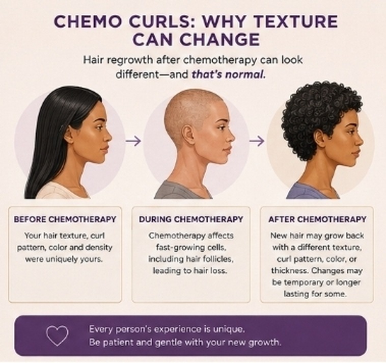 Chemo curls illustration comparing hair before chemotherapy, during chemotherapy, and after chemotherapy when new hair may return with a different texture, curl pattern, color or thickness